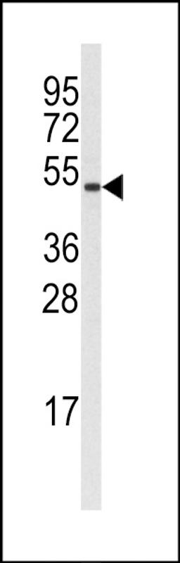 Western blot analysis of (S126) in A375 cell line lysates (35ug/lane)