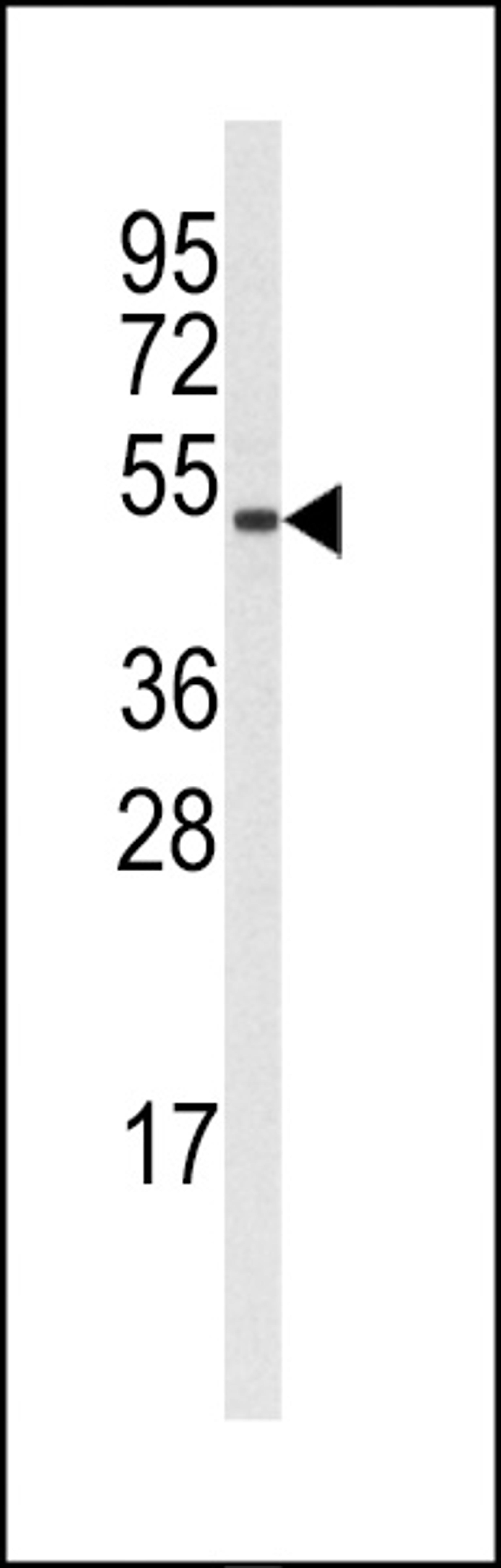 Western blot analysis of (S126) in A375 cell line lysates (35ug/lane)