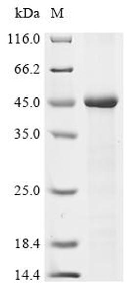 (Tris-Glycine gel) Discontinuous SDS-PAGE (reduced) with 5% enrichment gel and 15% separation gel.