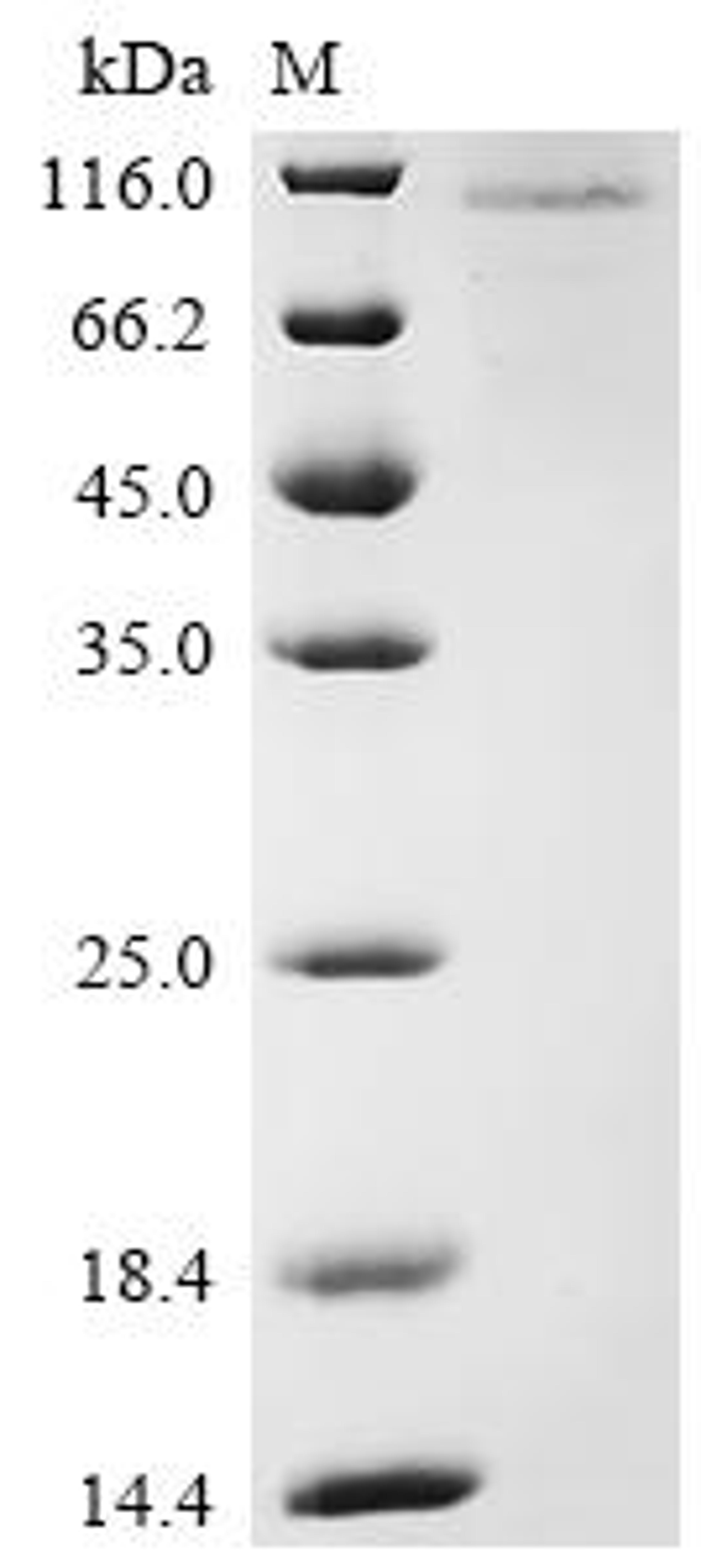(Tris-Glycine gel) Discontinuous SDS-PAGE (reduced) with 5% enrichment gel and 15% separation gel.