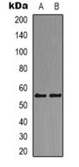 Western blot analysis of Jurkat (Lane 1), K562 (Lane 2) whole cell lysates using DOK2 antibody