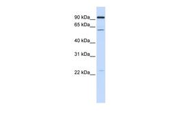 Antibody used in WB on Human HeLa at 0.2-1 ug/ml.