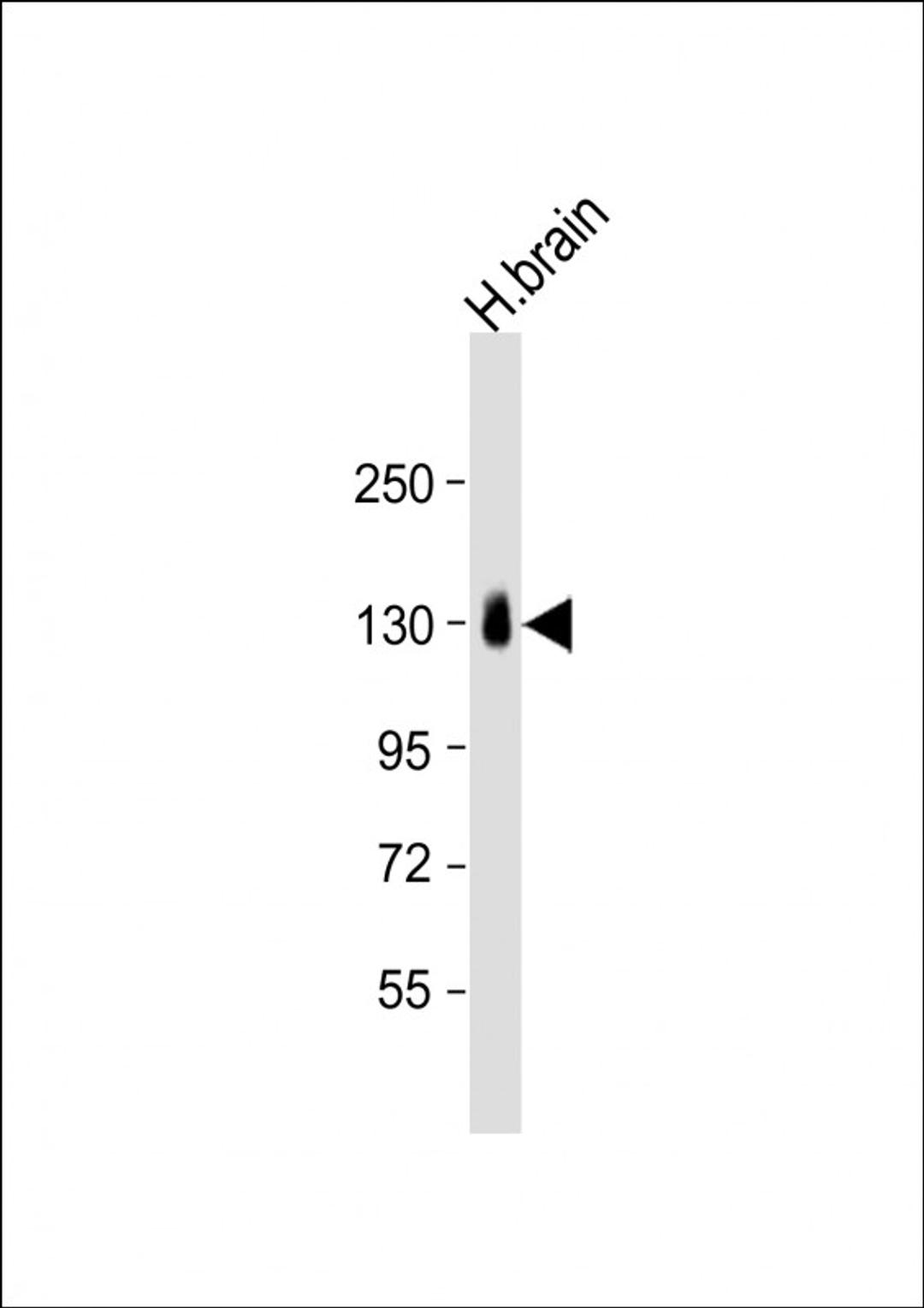 Western Blot at 1:1000 dilution + human brain lysate Lysates/proteins at 20 ug per lane.