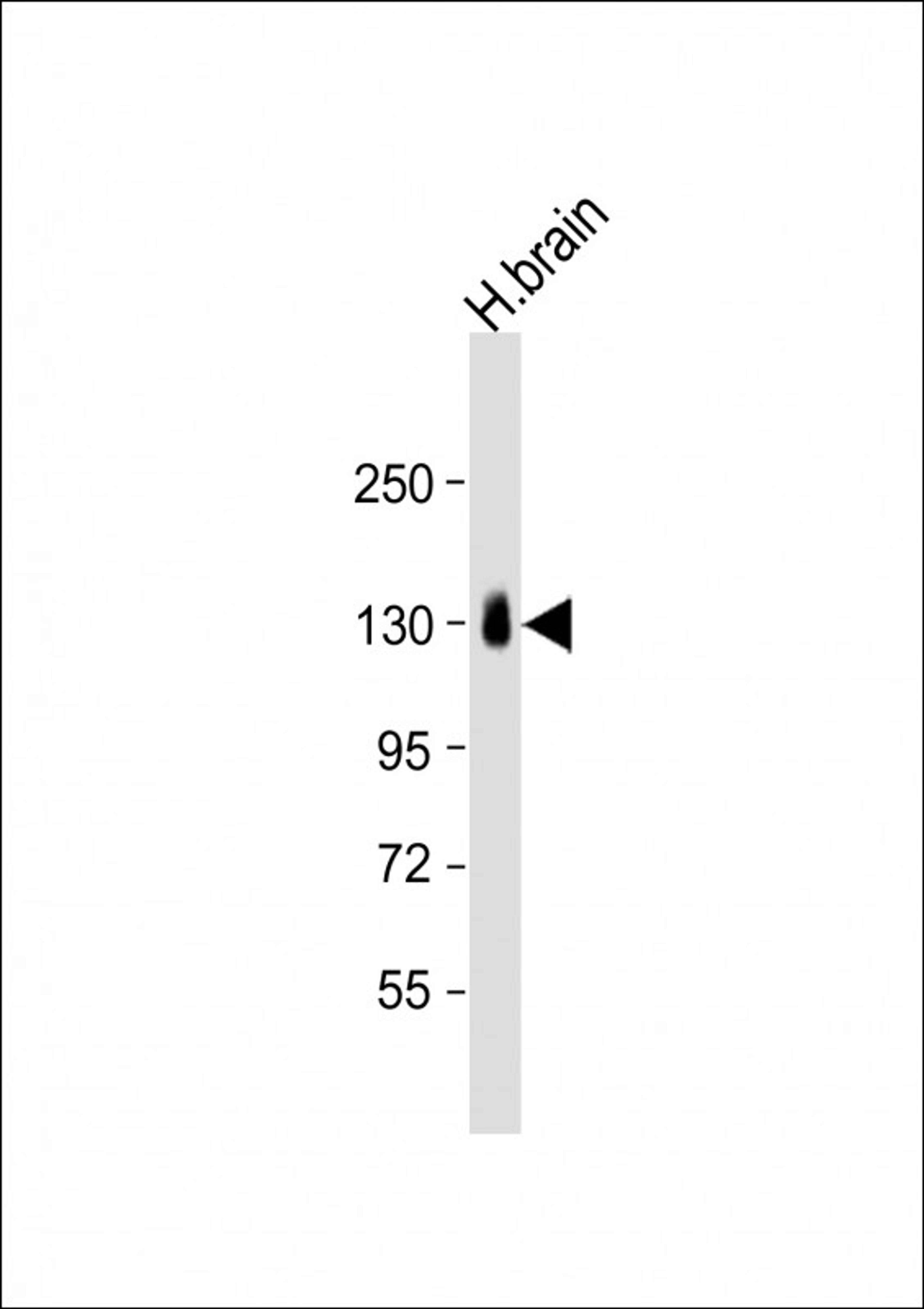 Western Blot at 1:1000 dilution + human brain lysate Lysates/proteins at 20 ug per lane.