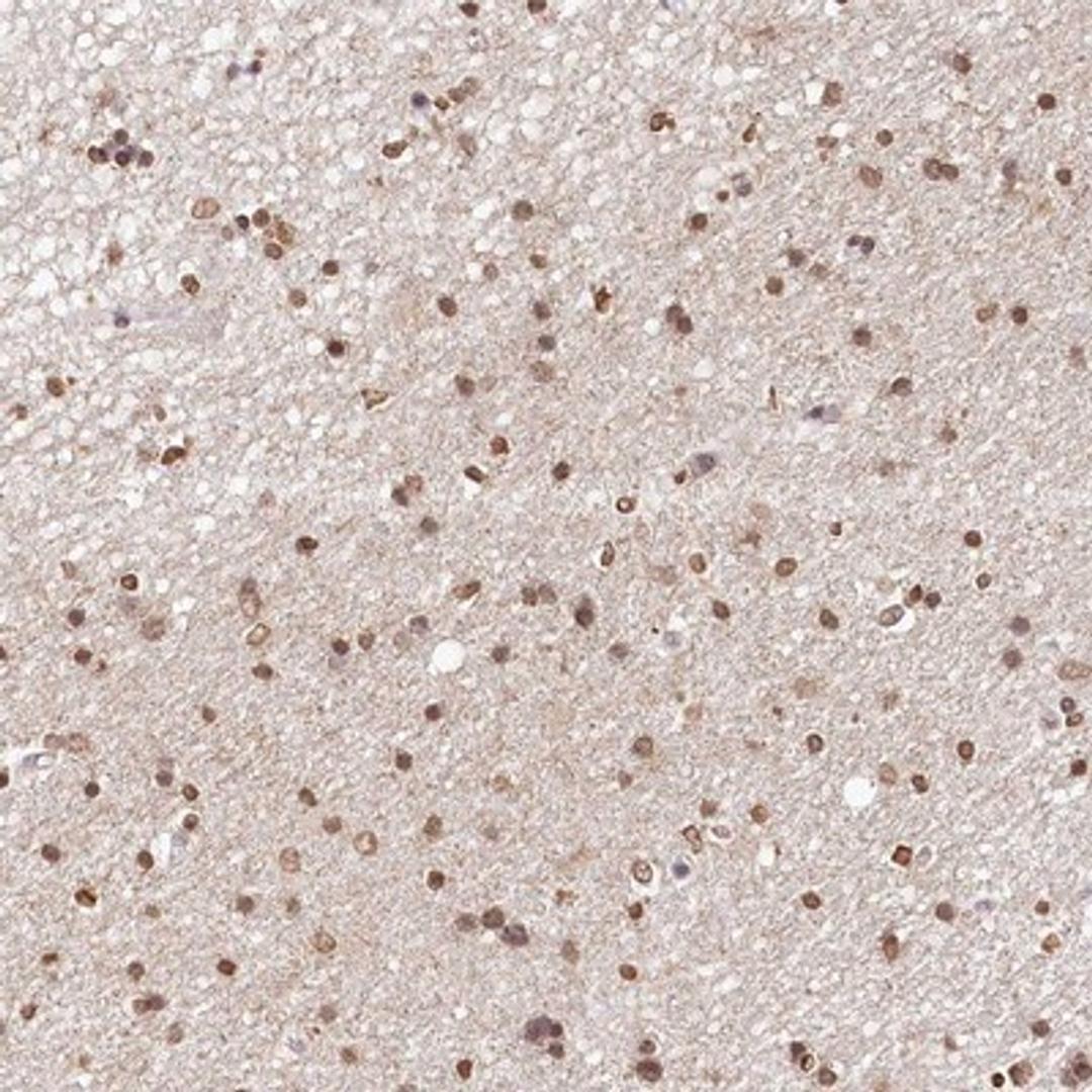 Immunohistochemistry-Paraffin: DMXL1 Antibody [NBP1-90998] - Staining of human hippocampus shows moderate nuclear positivity in glial cells.