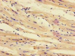 Immunohistochemistry of paraffin-embedded human heart tissue using CSB-PA012188LA01HU at dilution of 1:100