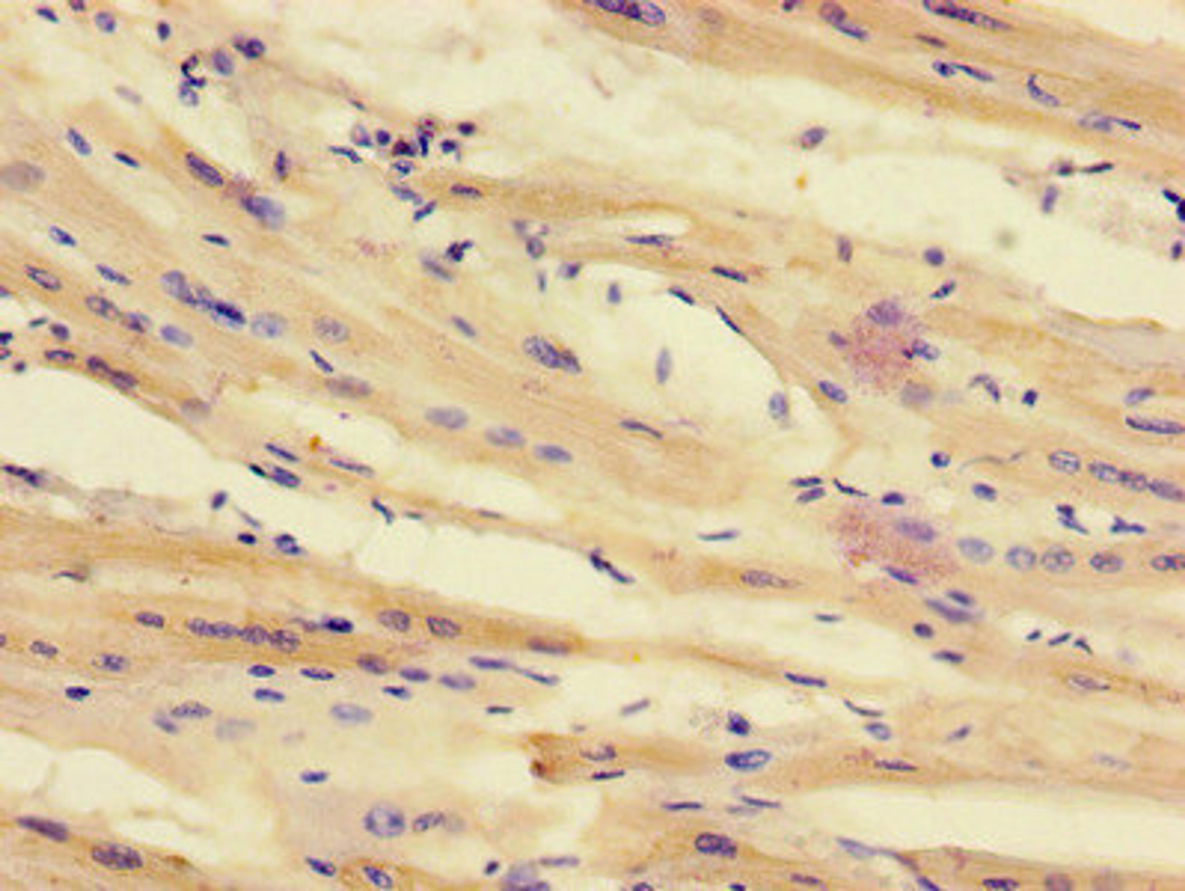 Immunohistochemistry of paraffin-embedded human heart tissue using CSB-PA012188LA01HU at dilution of 1:100