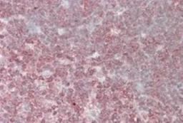 Immunohistochemistry-Paraffin: CrkL Antibody [NB300-884] - 3.8ug/ml staining of paraffin embedded Human Thymus. Steamed antigen retrieval with citrate buffer pH 6, AP-staining.