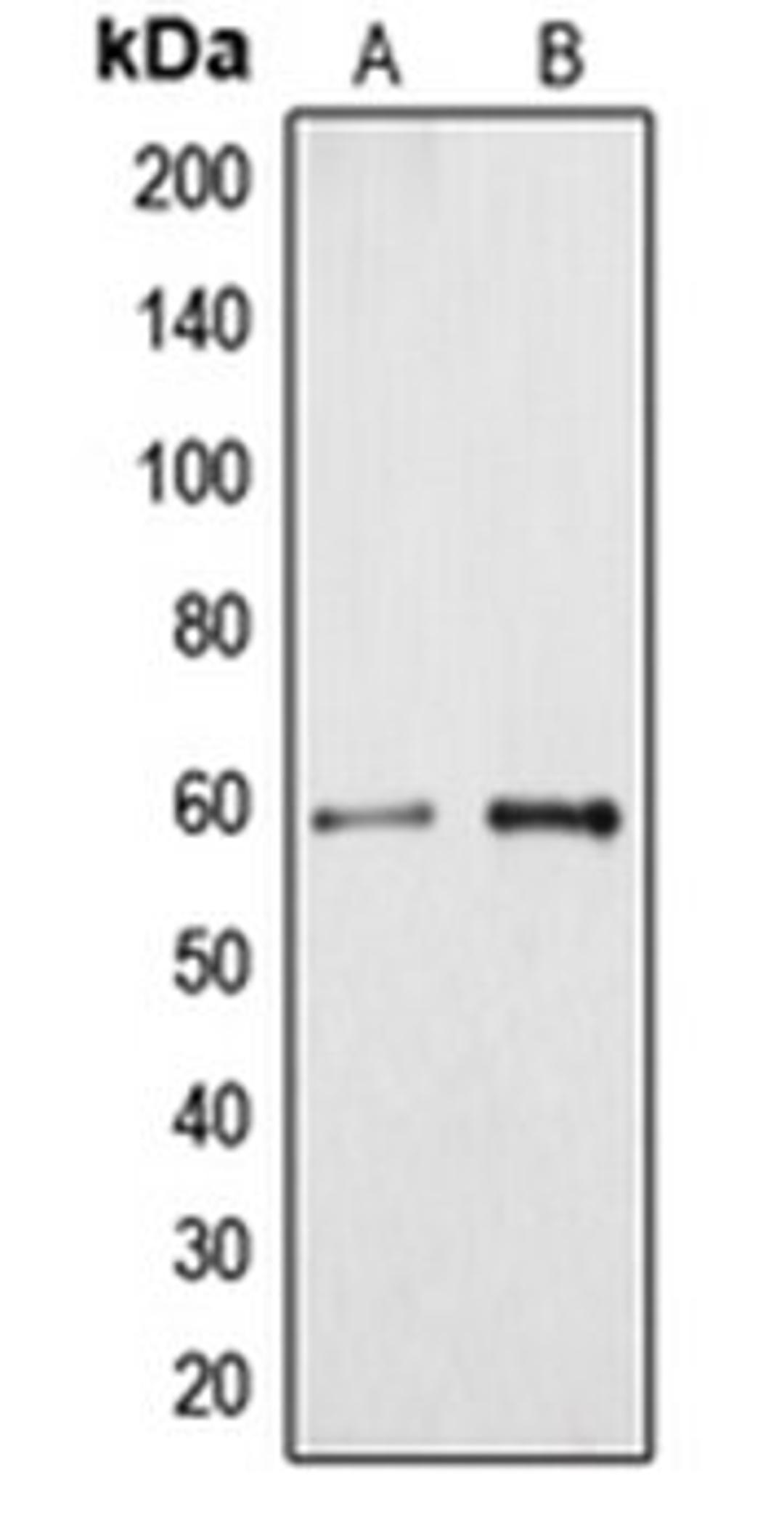 Western blot analysis of HeLa (Lane 1), HuvEc (Lane 2) whole cell lysates using CYP4A11 antibody