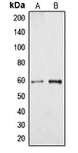 Western blot analysis of HeLa (Lane 1), HuvEc (Lane 2) whole cell lysates using CYP4A11 antibody