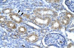 Antibody used in IHC on Human kidney.