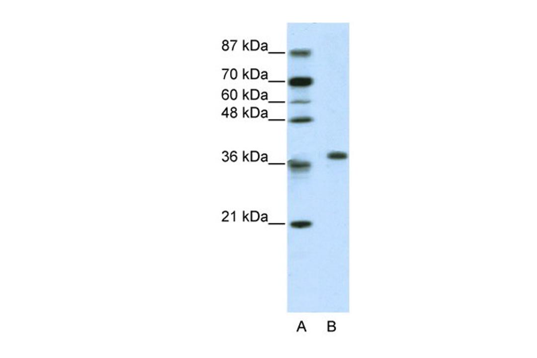 Antibody used in WB on Human Jurkat 2.5 ug/ml.