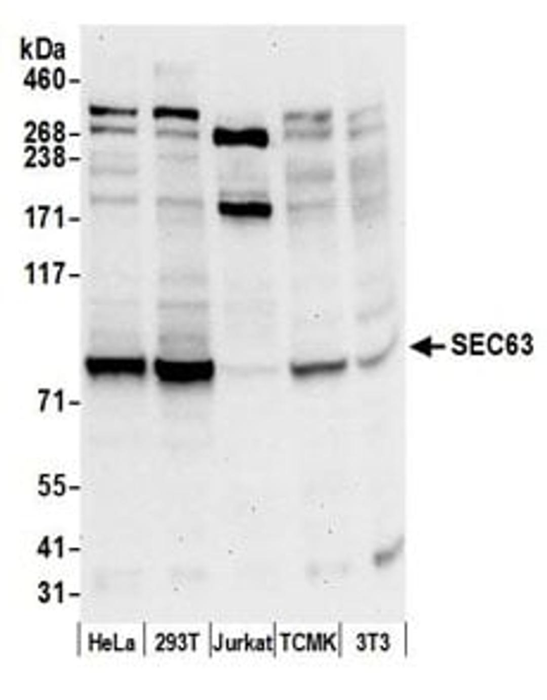 Detection of human and mouse SEC63 by western blot.