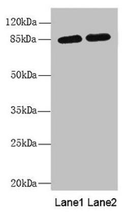 Western blot. All lanes: MAGED1 antibody at 5.52µg/ml. Lane 1: A375 whole cell lysate. Lane 2: 293T whole cell lysate. Secondary. Goat polyclonal to rabbit IgG at 1/10000 dilution. Predicted band size: 87, 92 kDa. Observed band size: 87 kDa