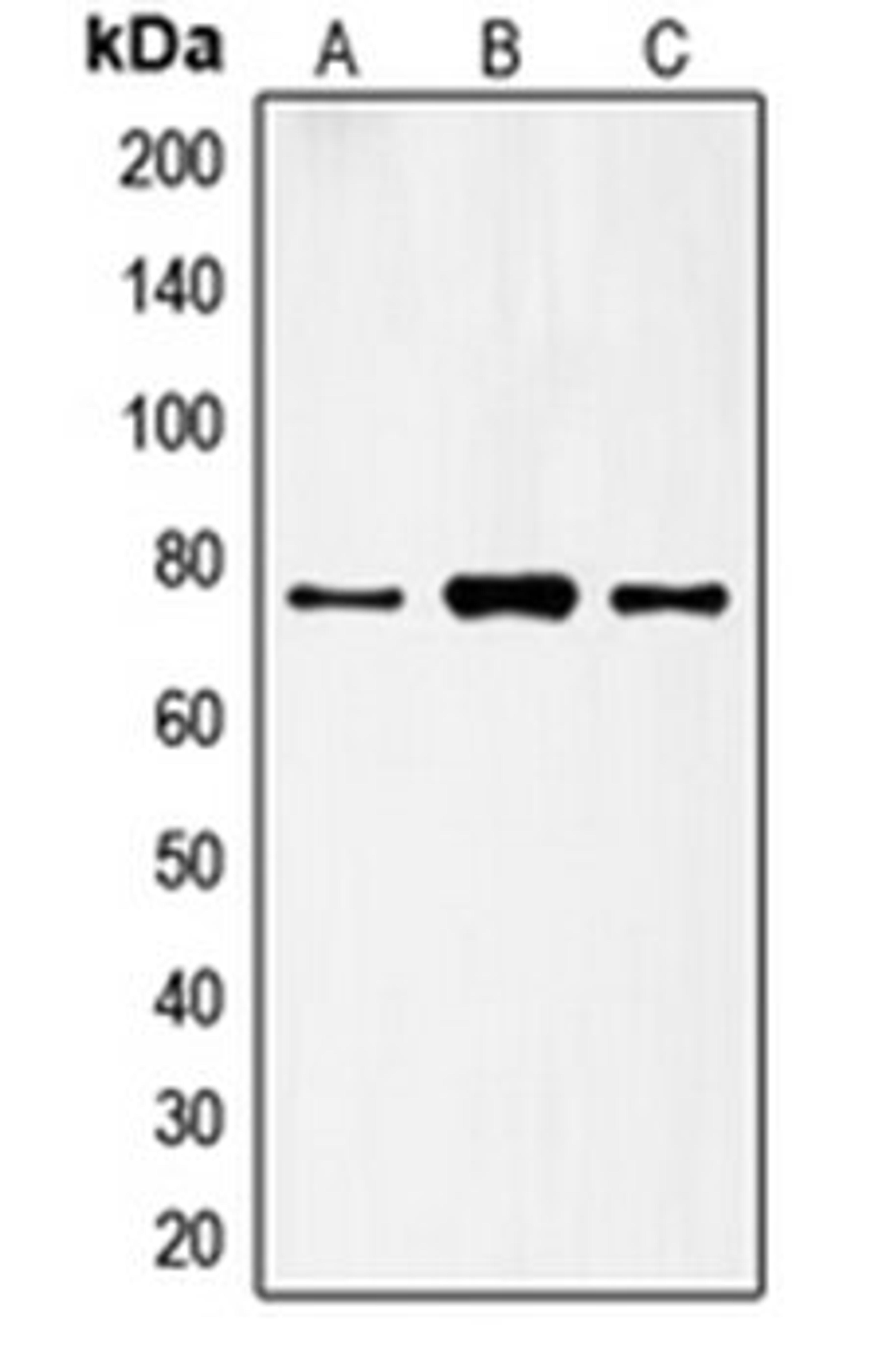 Western blot analysis of HeLa (Lane 1), A431 (Lane 2), H1299 (Lane 3) whole cell lysates using FSHR antibody