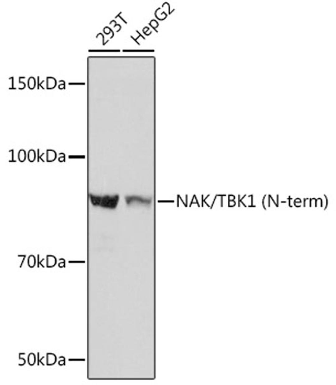 Western blot - NAK/TBK1 (N-term) Rabbit mAb (A3458)