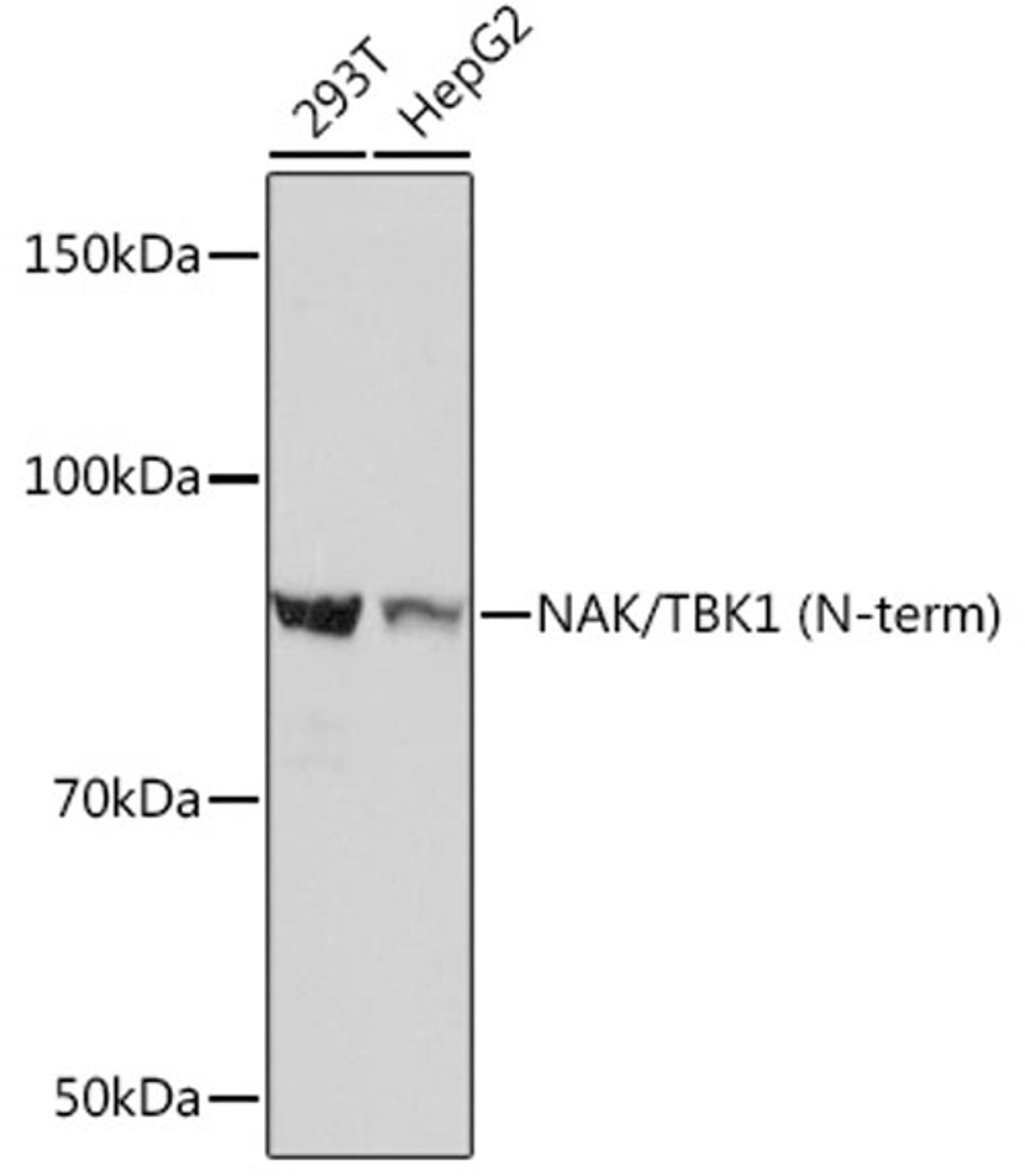 Western blot - NAK/TBK1 (N-term) Rabbit mAb (A3458)