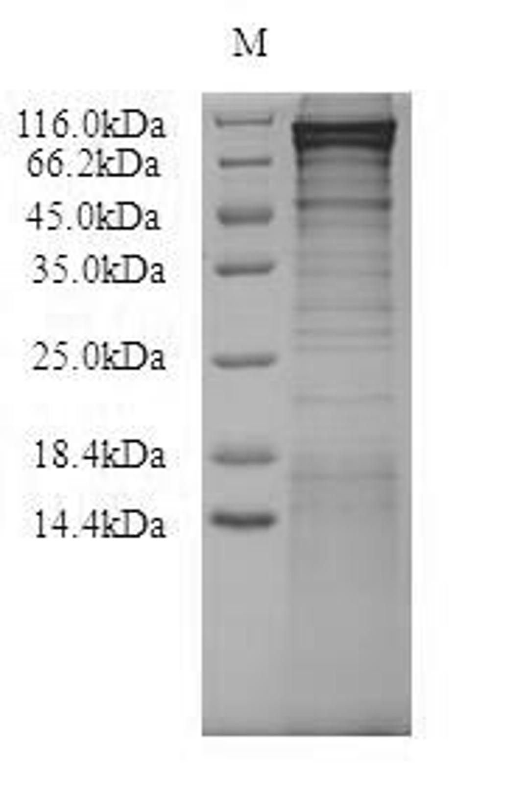 (Tris-Glycine gel) Discontinuous SDS-PAGE (reduced) with 5% enrichment gel and 15% separation gel.