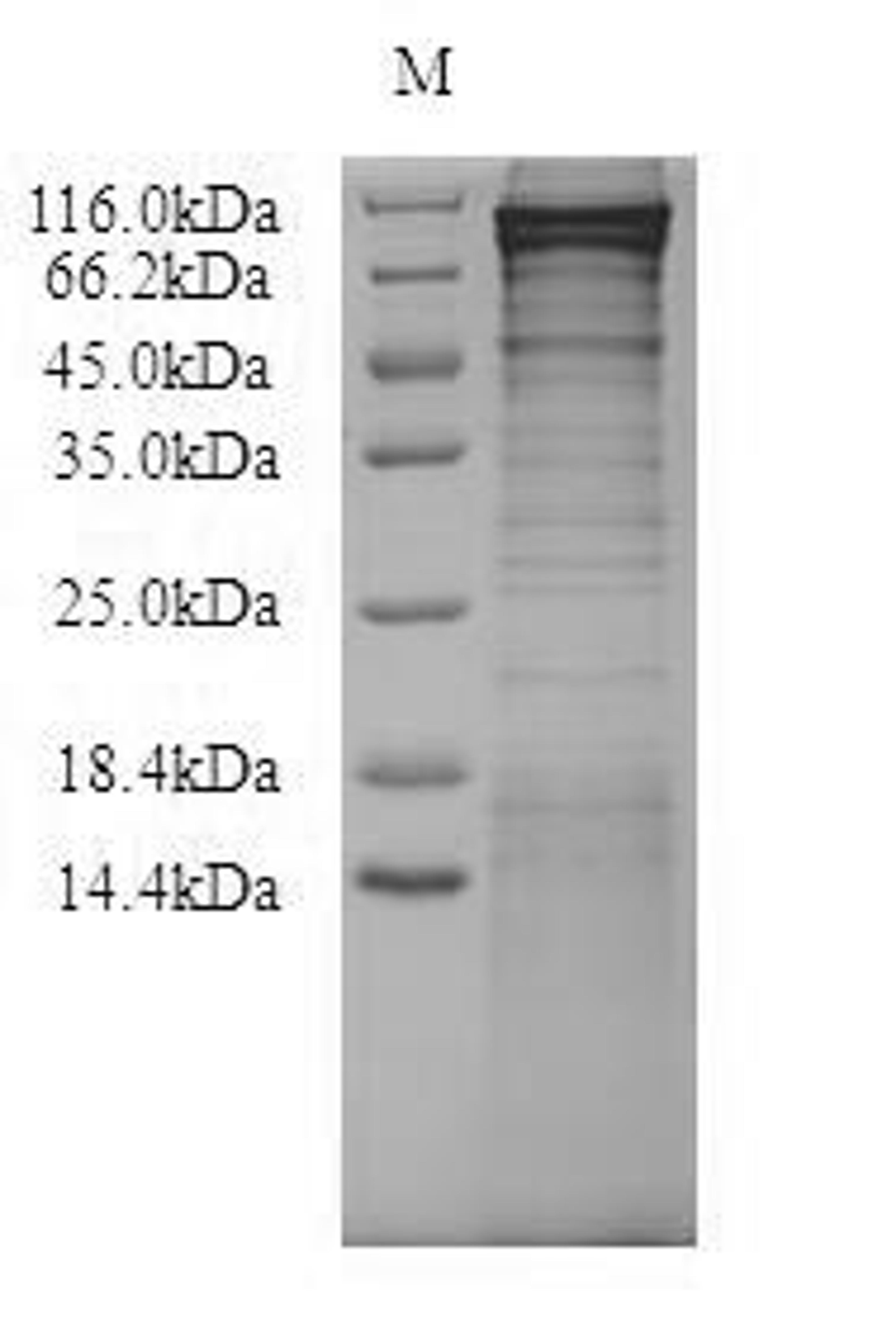 (Tris-Glycine gel) Discontinuous SDS-PAGE (reduced) with 5% enrichment gel and 15% separation gel.