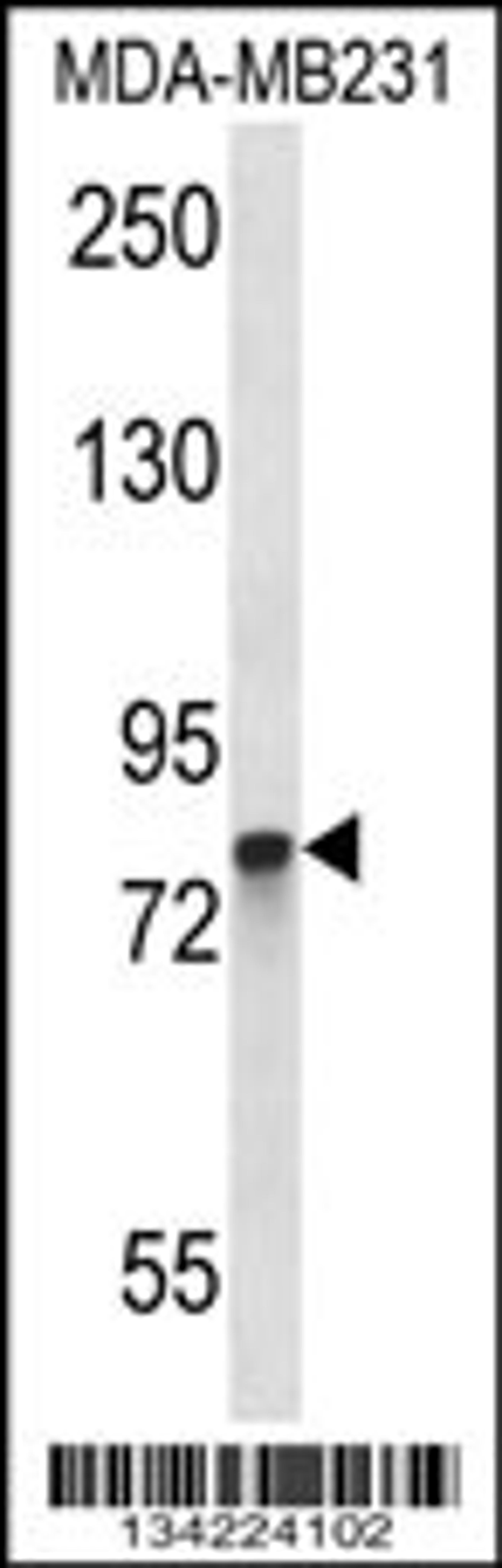 Western blot analysis in MDA-MB231 cell line lysates (35ug/lane).