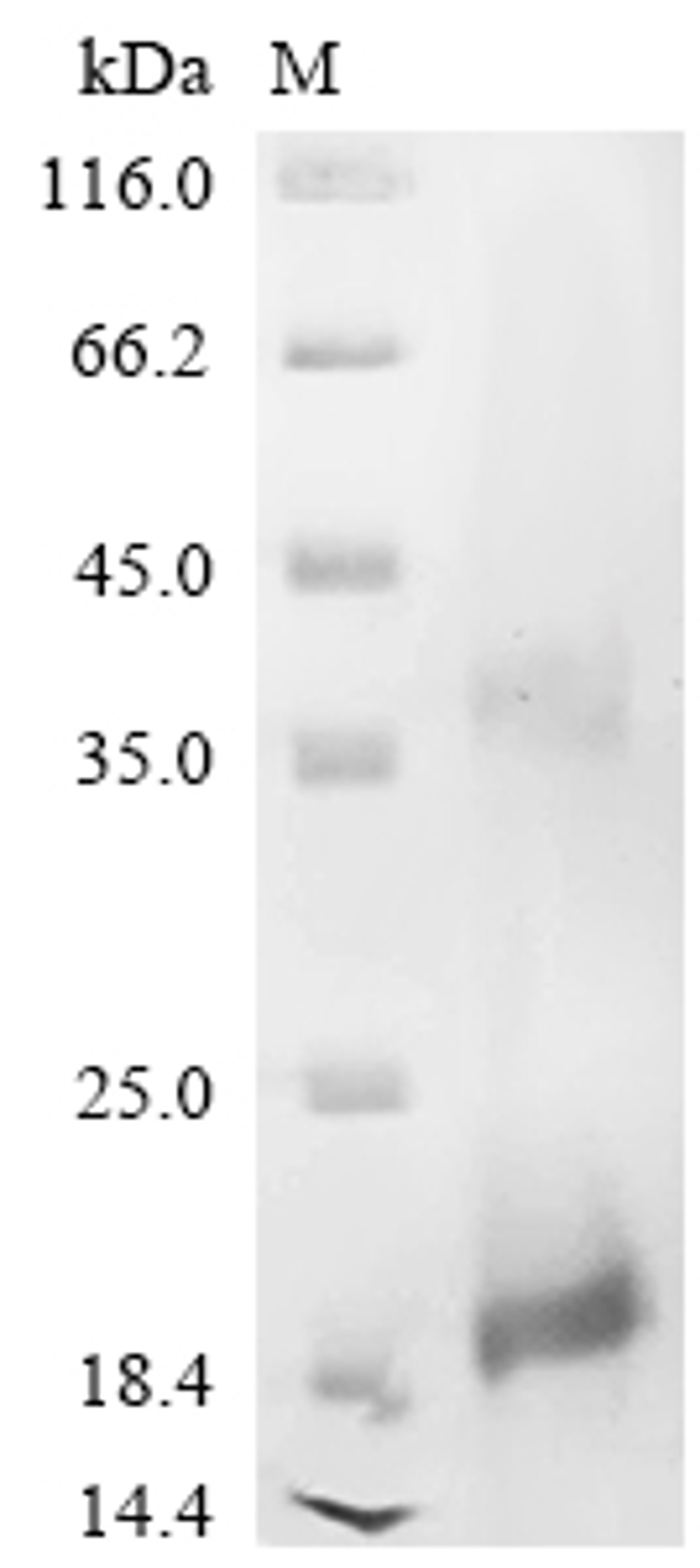 (Tris-Glycine gel) Discontinuous SDS-PAGE (reduced) with 5% enrichment gel and 15% separation gel.