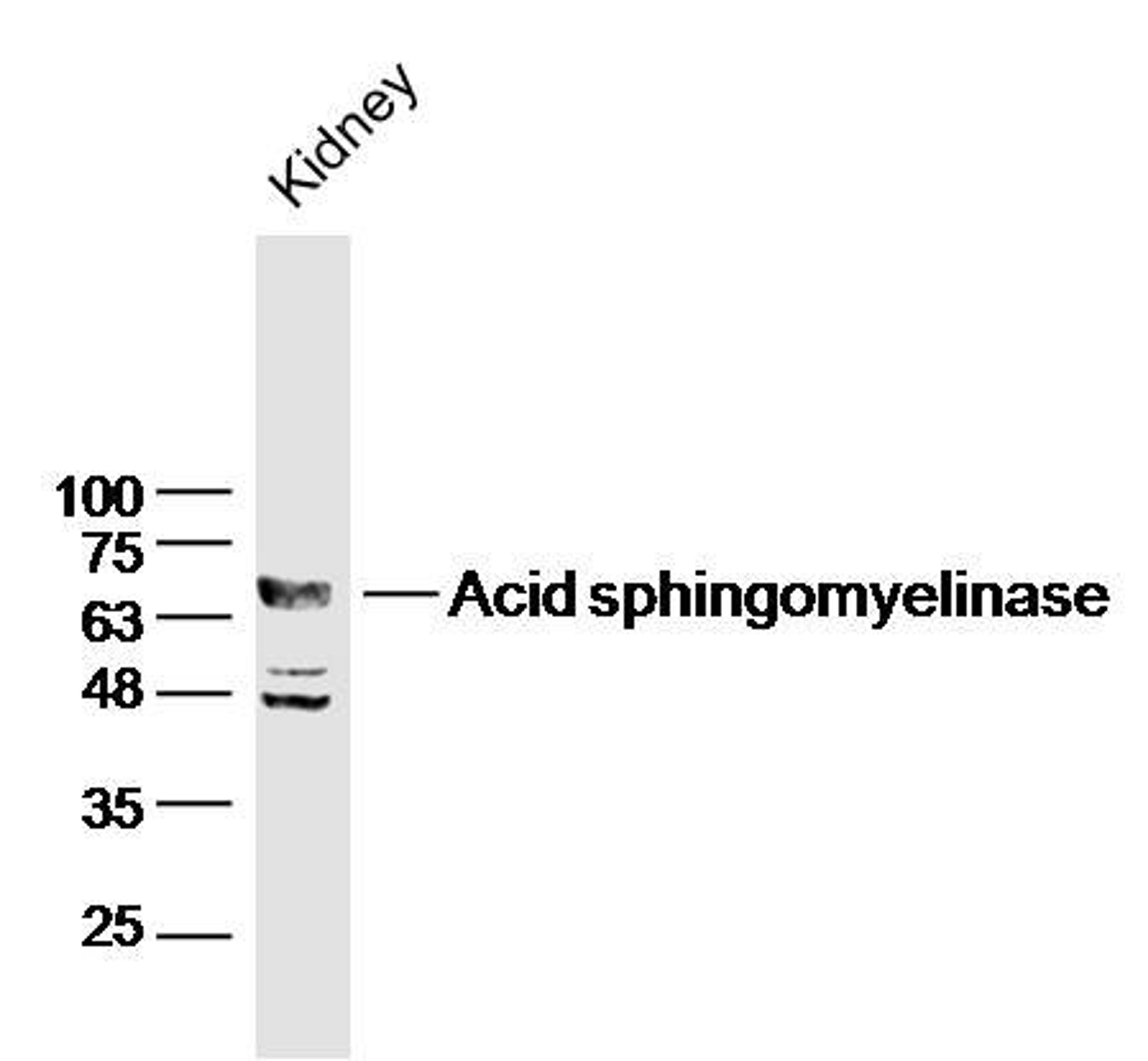 WB analysis of Raw246.7 Cell Lysate using ASM antibody