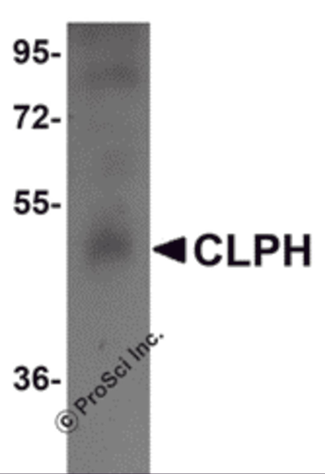Western blot analysis of CLPH in human testis tissue lysate with CLPH antibody at 1 μg/mL.