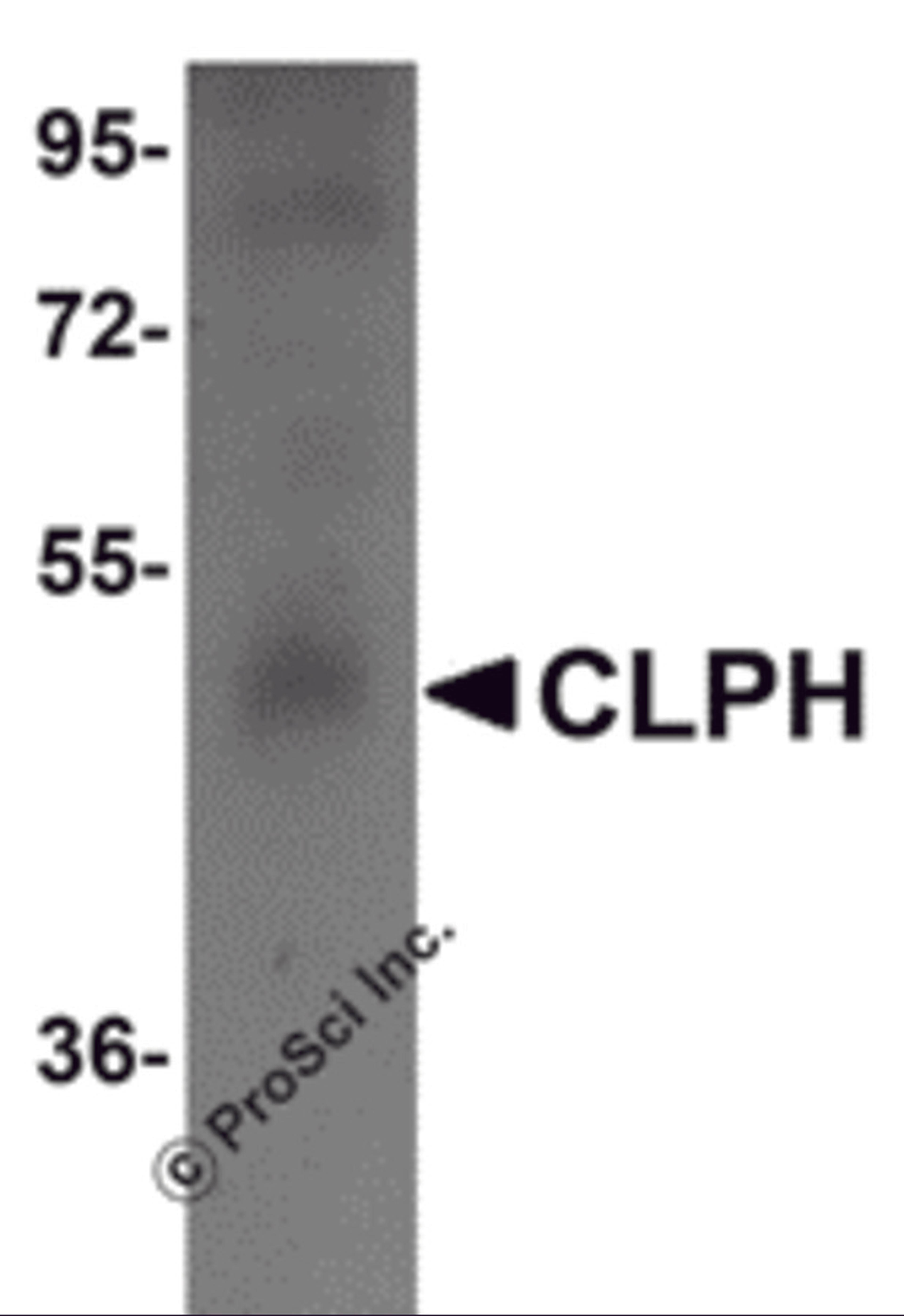 Western blot analysis of CLPH in human testis tissue lysate with CLPH antibody at 1 μg/mL.