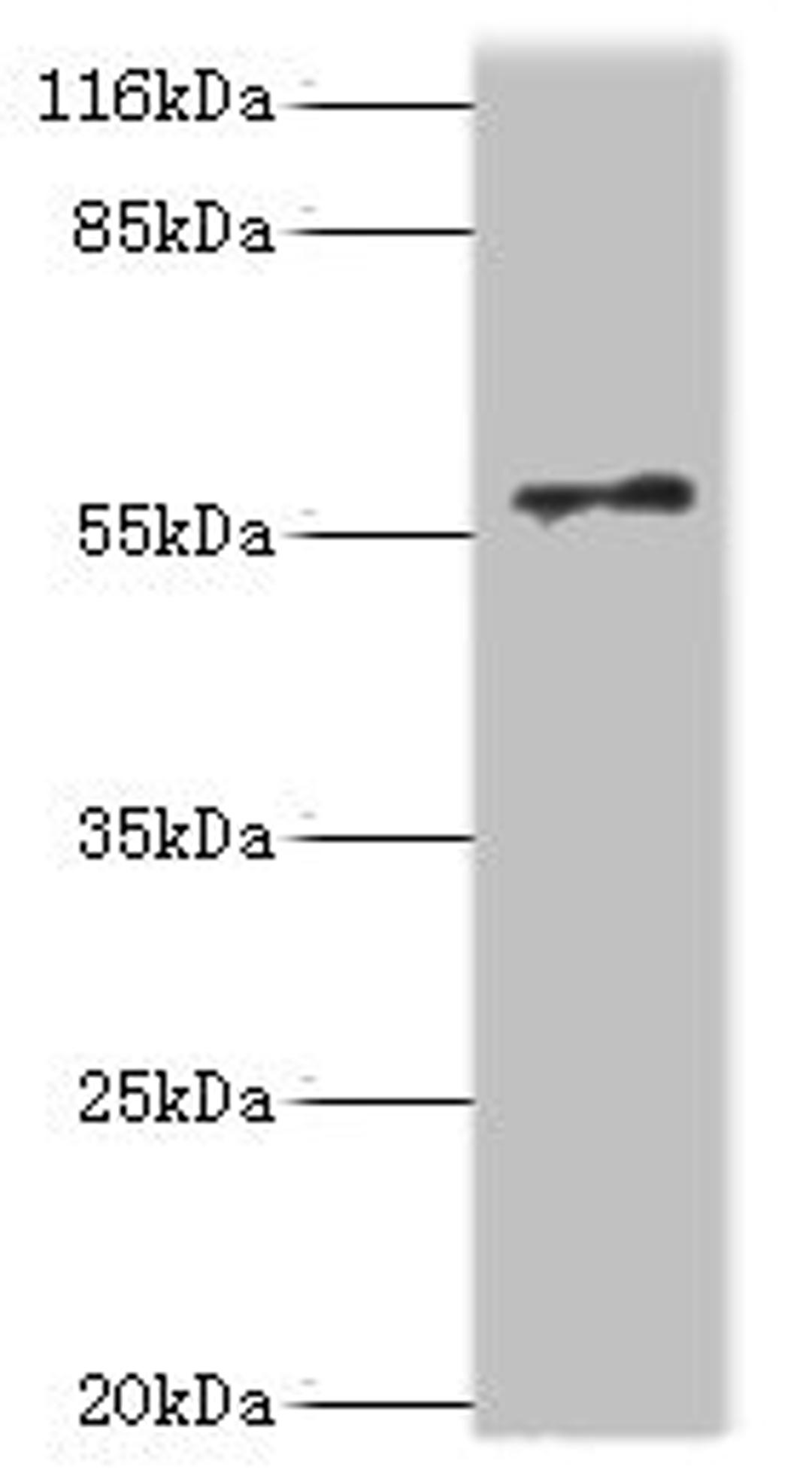 Western blot. All lanes: RAD18 antibody at 2µg/ml + COLO205 whole cell lysate. Secondary. Goat polyclonal to rabbit IgG at 1/10000 dilution. Predicted band size: 57 kDa. Observed band size: 57 kDa