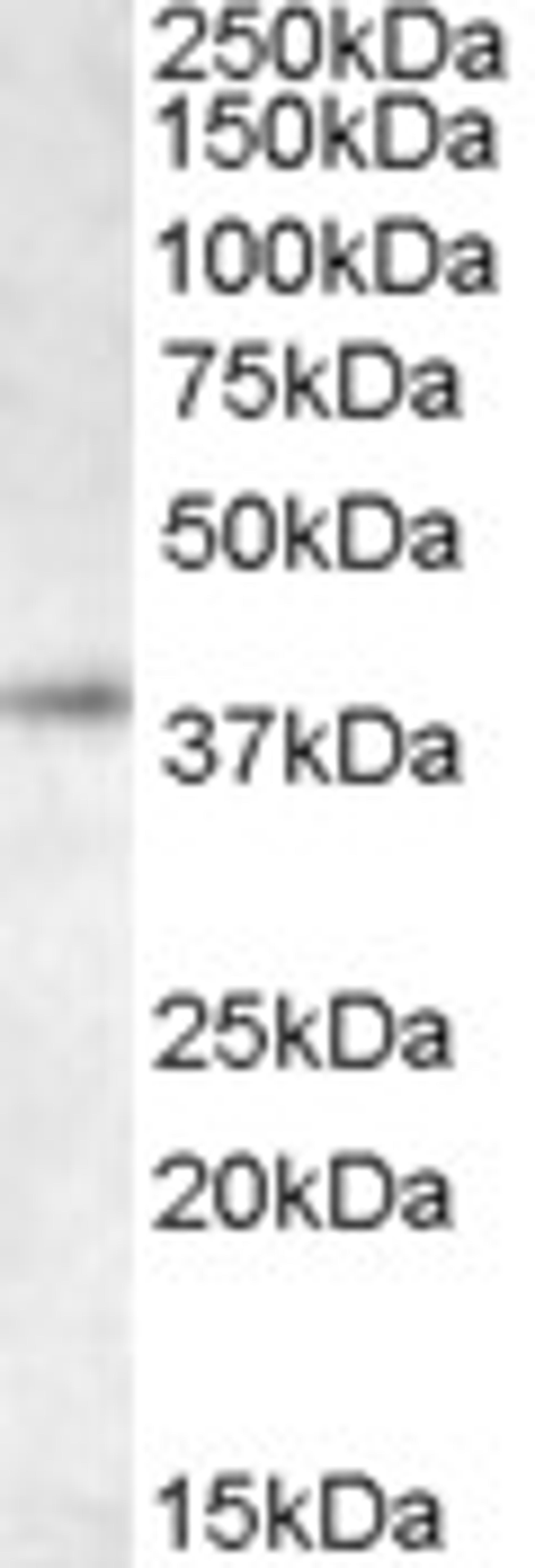 46-304 staining (0.5 ug/ml) of K562 lysate (RIPA buffer, 35ug total protein per lane). Primary incubated for 1 hour. Detected by western blot using chemiluminescence.