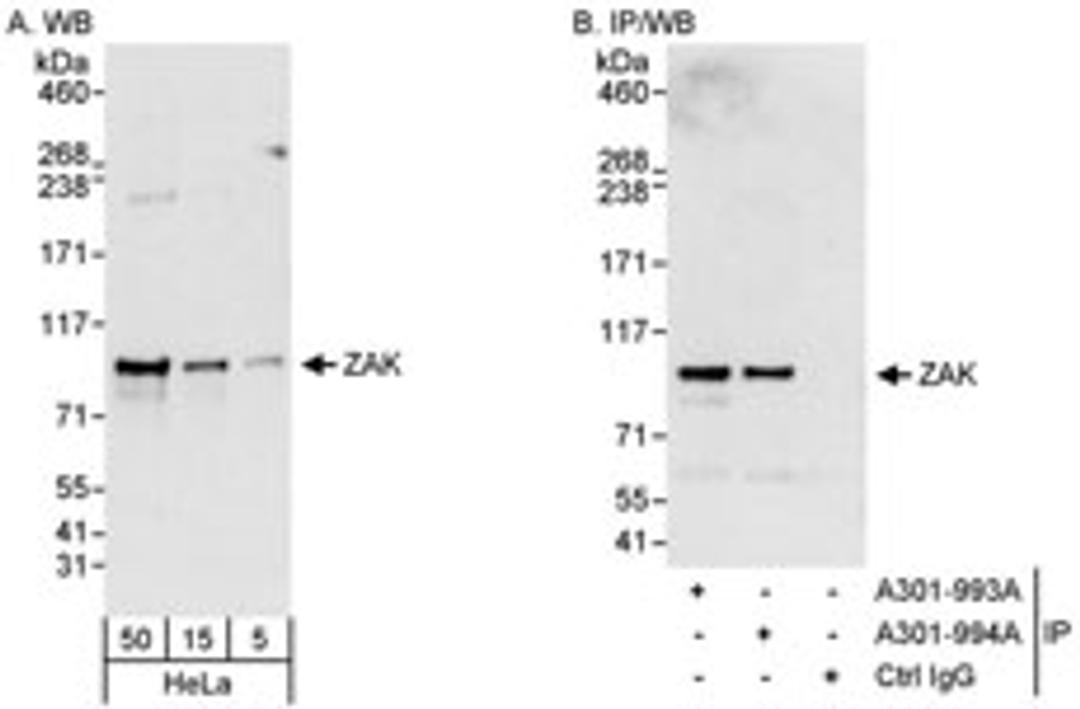 Detection of human ZAK by western blot and immunoprecipitation.