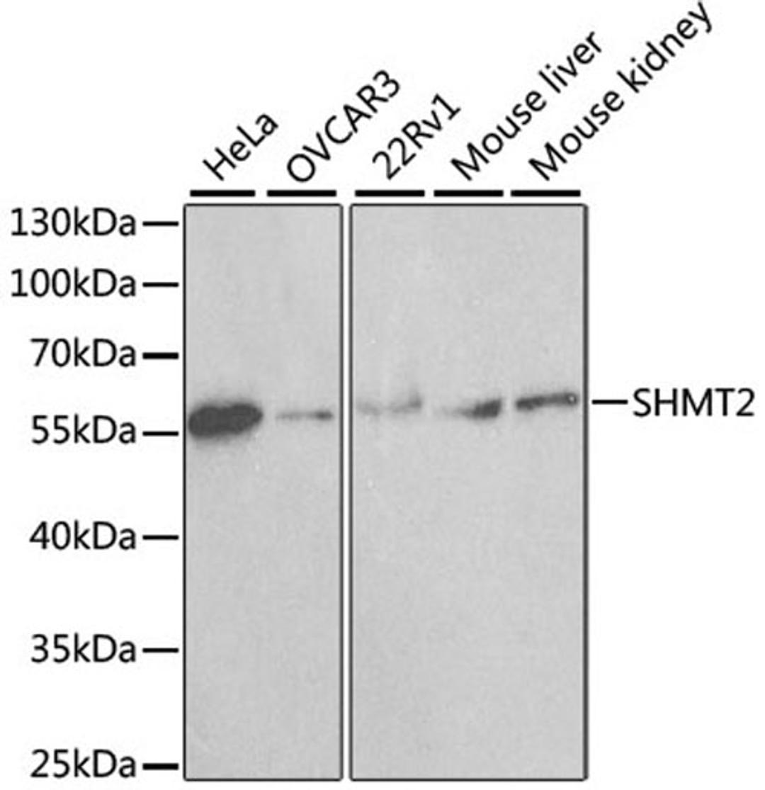 Western blot - SHMT2 antibody (A1215)