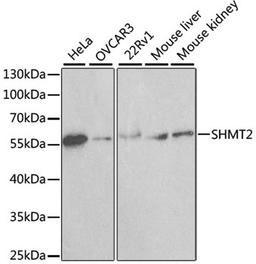 Western blot - SHMT2 antibody (A1215)