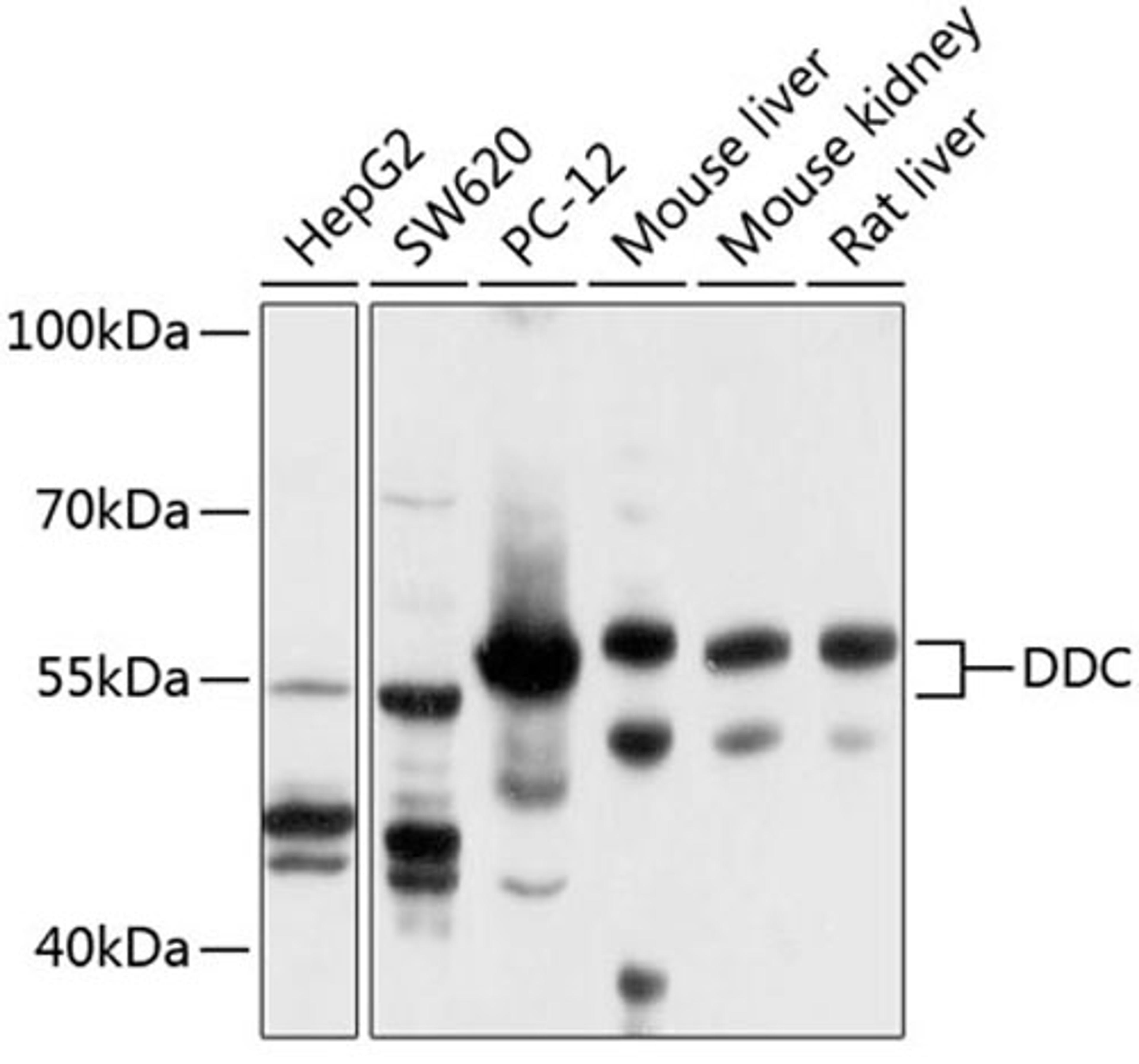 Western blot - DDC antibody (A3828)