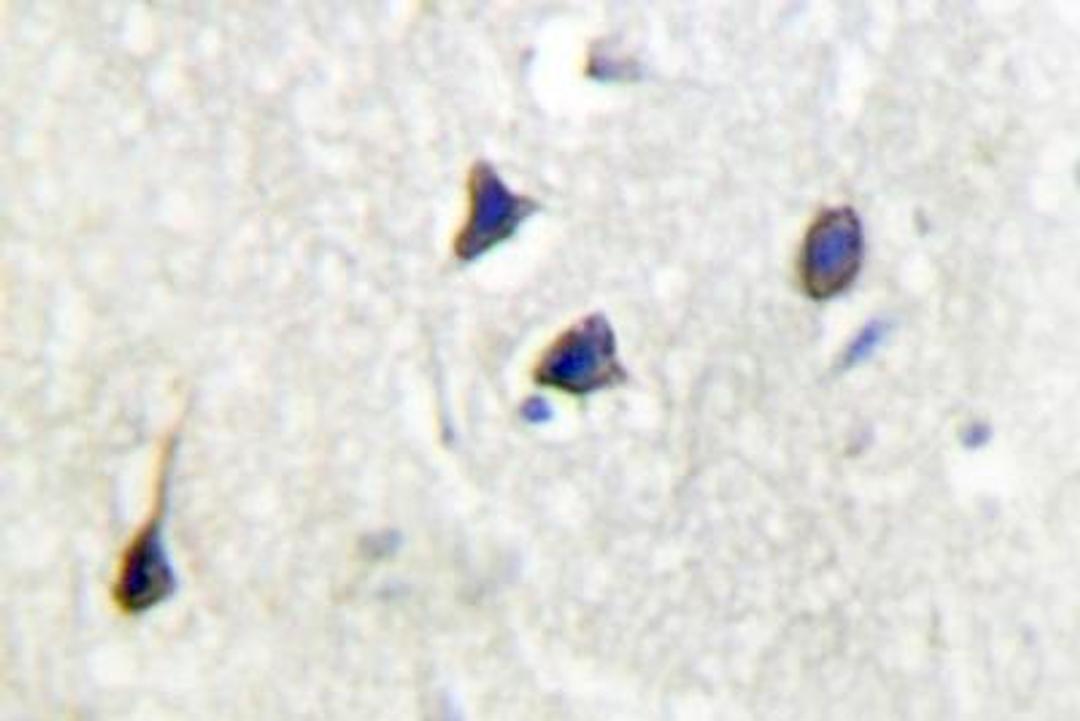 Immunohistochemistry-Paraffin: Adenylate Cyclase 5/6 Antibody [NB100-92437] - Paraffin-embedded human brain tissue.