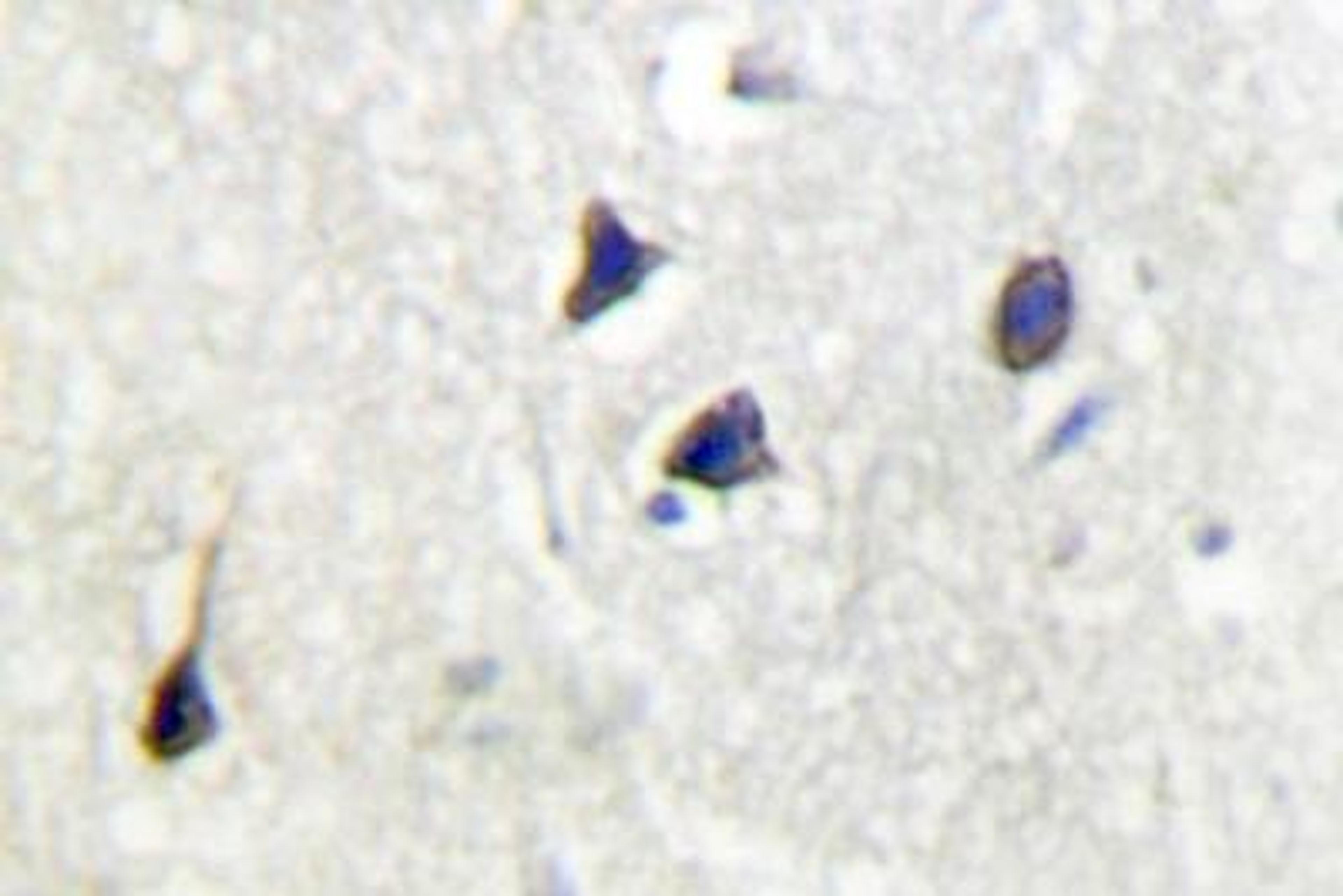 Immunohistochemistry-Paraffin: Adenylate Cyclase 5/6 Antibody [NB100-92437] - Paraffin-embedded human brain tissue.