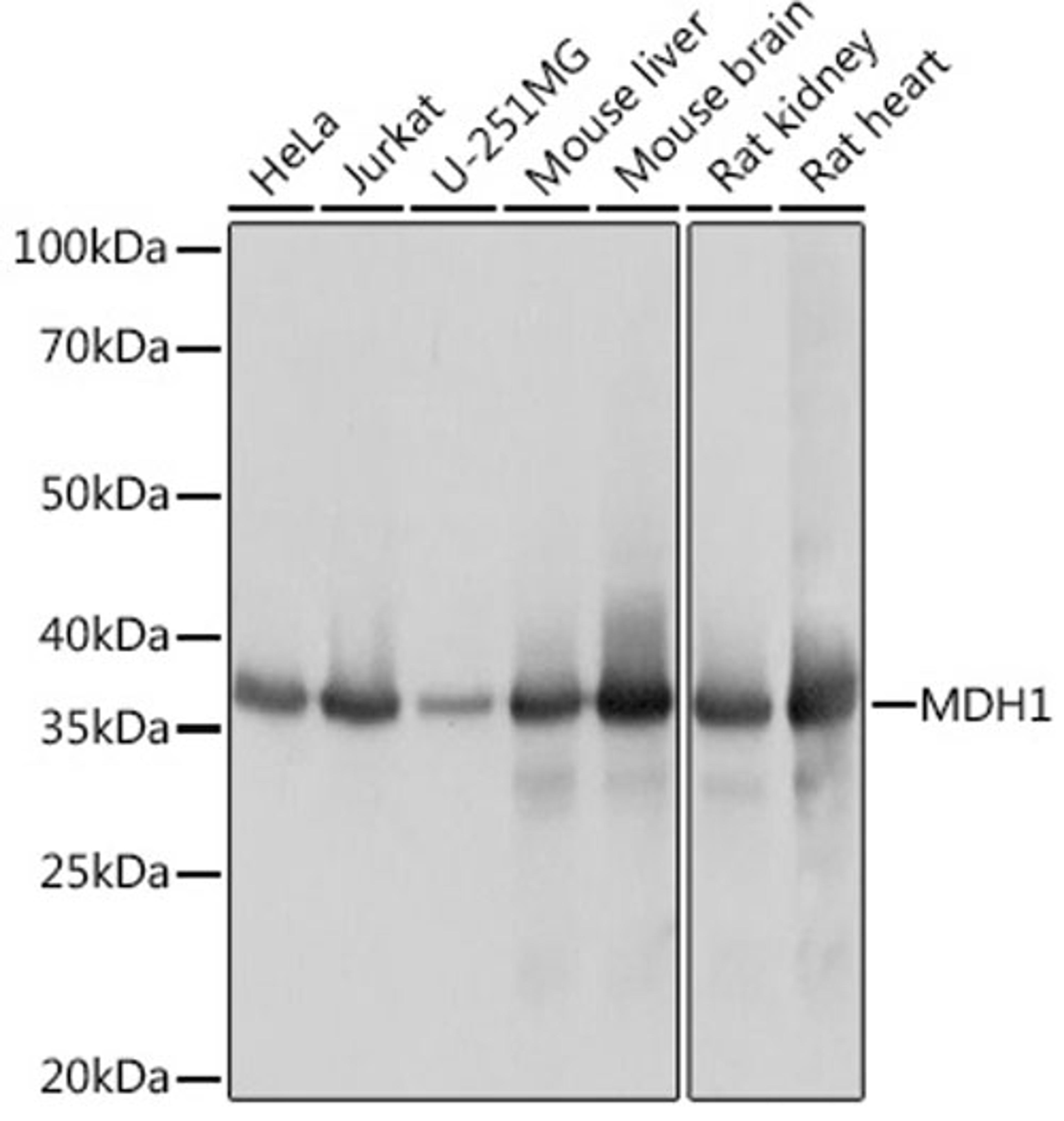 Western blot - MDH1 Rabbit mAb (A9673)