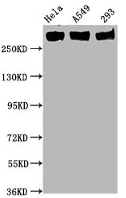 Western Blot. Positive WB detected in Hela whole cell lysate,A549 whole cell lysate,293 whole cell lysate. All lanes Phospho-POLR2A antibody at 0.75μg/ml. Secondary. Goat polyclonal to rabbit IgG at 1/50000 dilution. Predicted band size: 270 KDa. Observed band size: 270 KDa. 