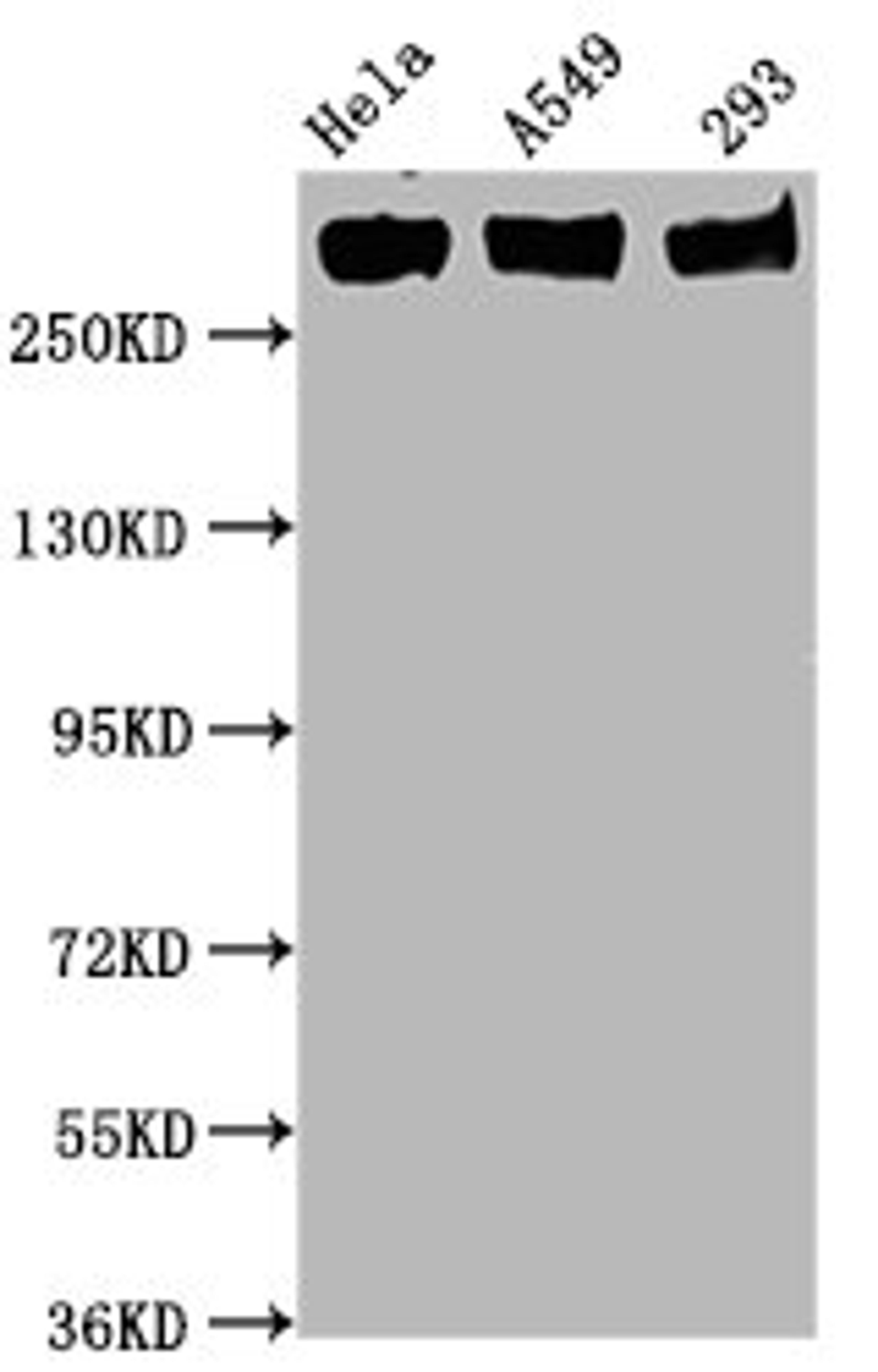 Western Blot. Positive WB detected in Hela whole cell lysate,A549 whole cell lysate,293 whole cell lysate. All lanes Phospho-POLR2A antibody at 0.75μg/ml. Secondary. Goat polyclonal to rabbit IgG at 1/50000 dilution. Predicted band size: 270 KDa. Observed band size: 270 KDa. 