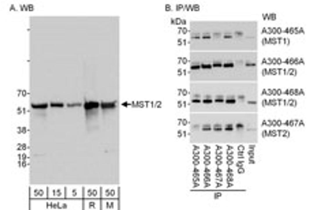 Detection of MST1 and MST2 by western blot and immunoprecipitation.