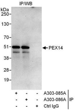 Detection of human PEX14 by western blot of immunoprecipitates.