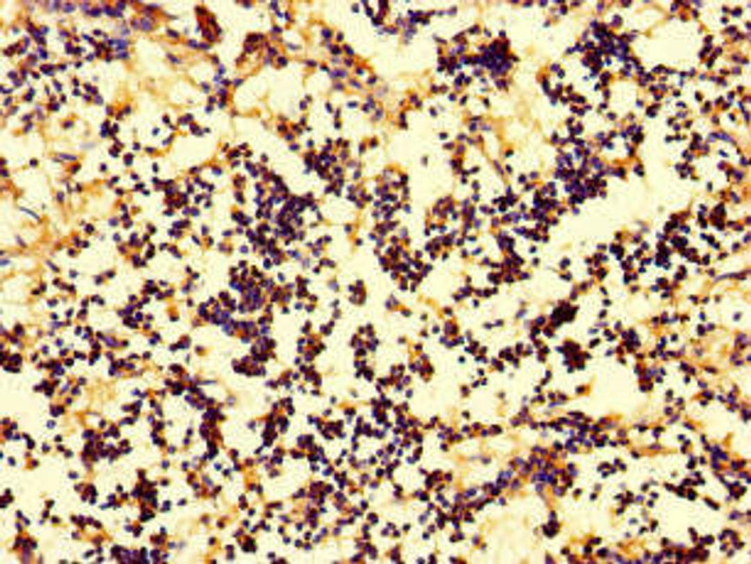 Immunohistochemistry of paraffin-embedded human appendix tissue using CSB-PA06659A0Rb at dilution of 1:100