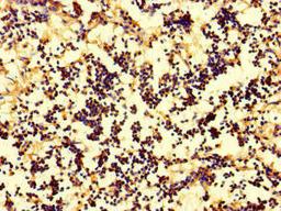 Immunohistochemistry of paraffin-embedded human appendix tissue using CSB-PA06659A0Rb at dilution of 1:100