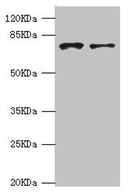 Western blot. All lanes: GBE1 antibody at 3.13ug/ml. Lane 1: HepG2 whole cell lysate. Lane 2: Hela whole cell lysate. Secondary. Goat polyclonal to rabbit IgG at 1/10000 dilution. Predicted band size: 80 kDa. Observed band size: 80 kDa.