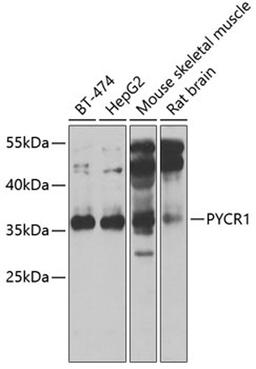 Western blot - PYCR1 antibody (A6959)