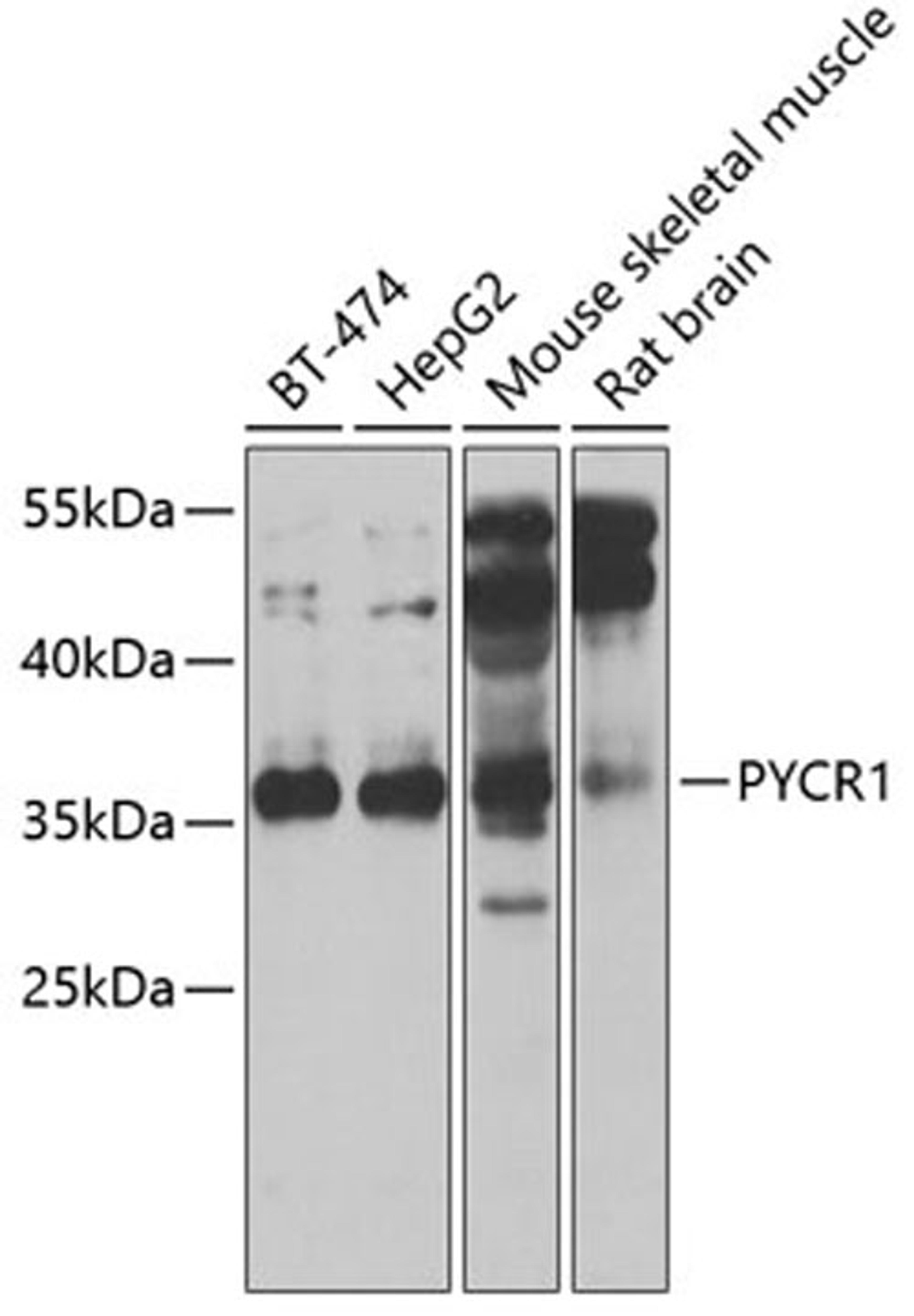 Western blot - PYCR1 antibody (A6959)