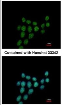 Immunocytochemistry/Immunofluorescence: PIBF1 Antibody [NBP2-19823] - Immunofluorescence analysis of methanol-fixed HCT116, using antibody at 1:500 dilution.