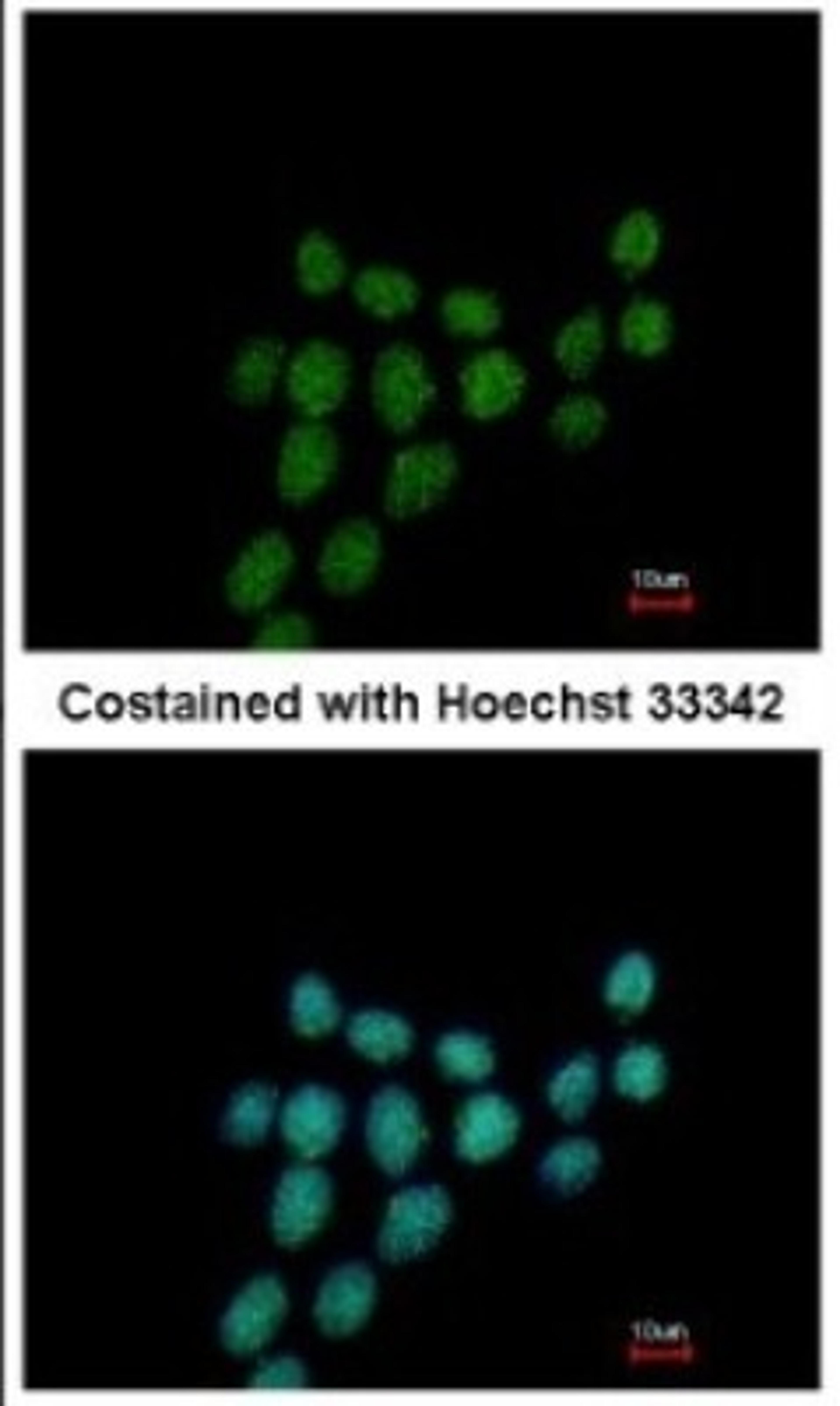 Immunocytochemistry/Immunofluorescence: PIBF1 Antibody [NBP2-19823] - Immunofluorescence analysis of methanol-fixed HCT116, using antibody at 1:500 dilution.