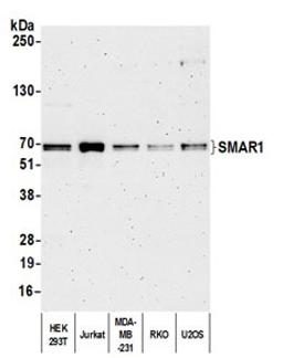 Detection of human SMAR1 by western blot.