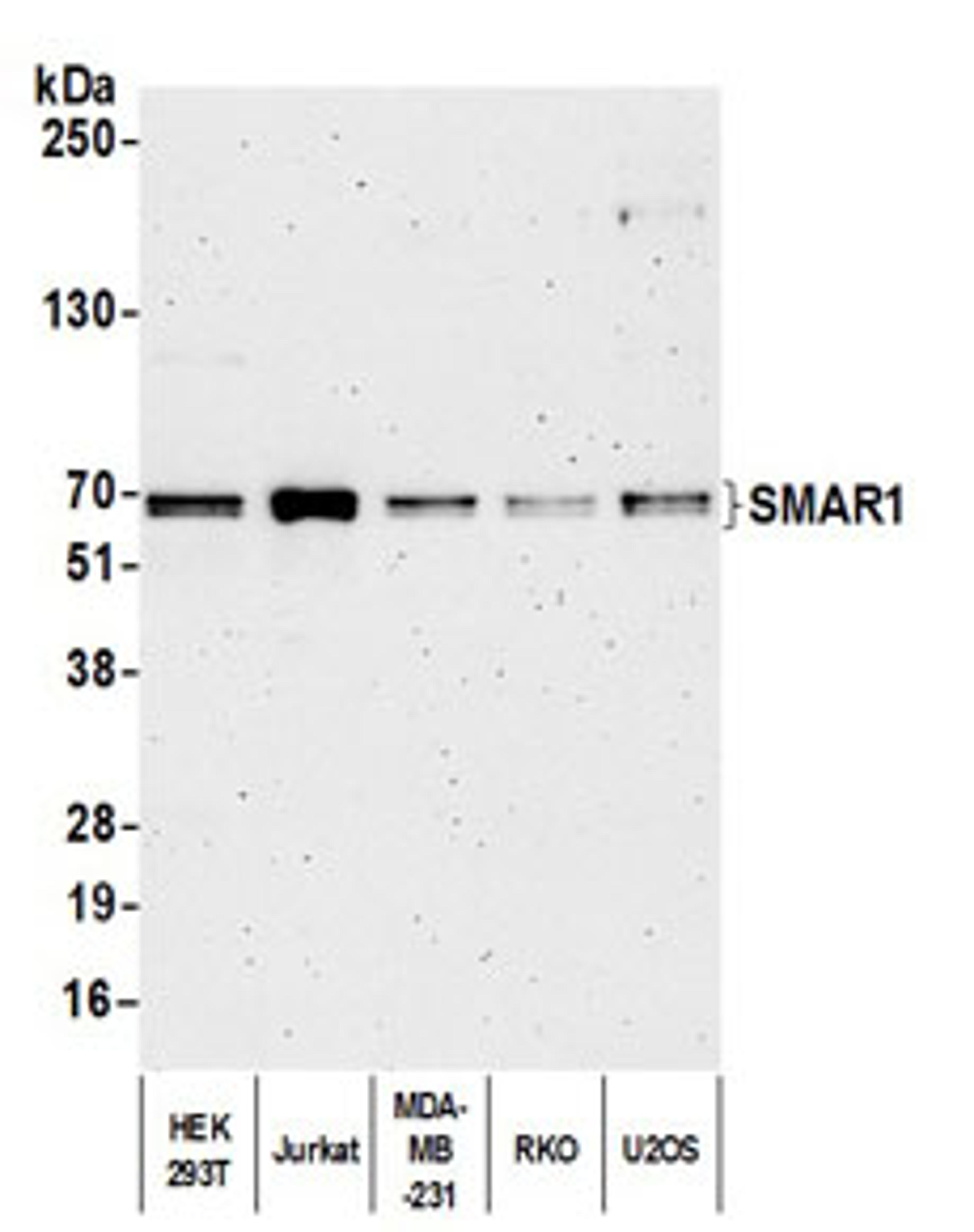 Detection of human SMAR1 by western blot.